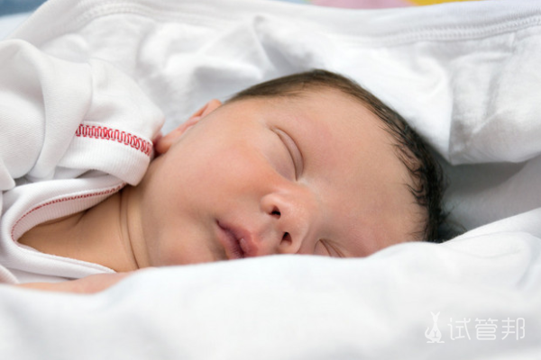 4e15fa8e5d194528bbcaf87320cb5c81.png 苯丙酮尿症发病机有哪些