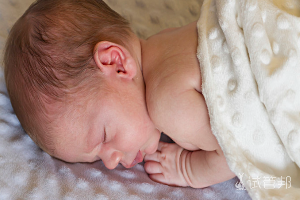 77941336327ced53d9a17705aedf60aa.png 苯丙酮尿症发病年龄是多少