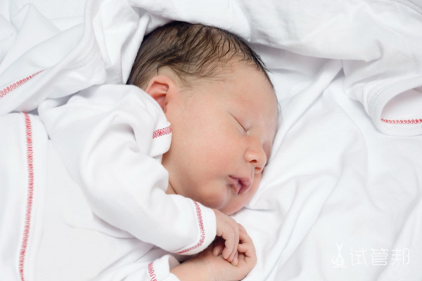 93b489cbe75b486b653c923ce5a2a135.png 苯丙酮尿症新生儿筛查方法是什么