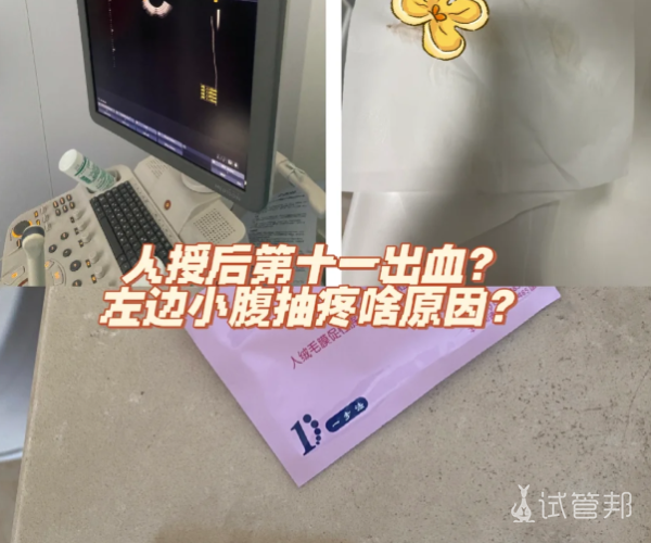 11a83e61526a860c55103051b00344db.png 我的人工授精全记录