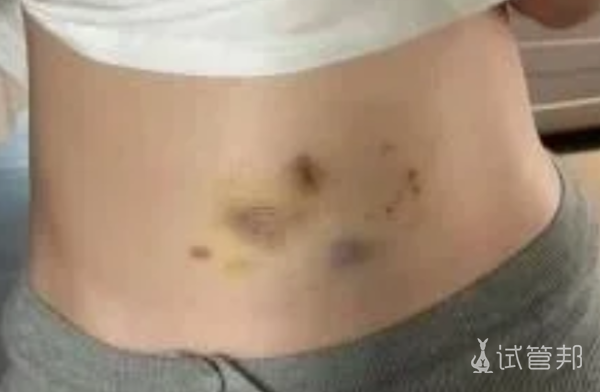 f01b0866fd24e6659653dfa2b9df81ca.png 试管一次成功经验总结来啦