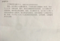 济宁医学院附属医院试管婴儿之路，分享我的详细求子经历！