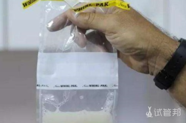 3576e931a1ef62ddba4cb13c31f0c5bd.png 男科检验室精液检测操作规范分享