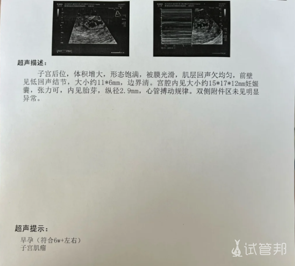 ef538ee6ca0022b808383a0e58f27d97.png 愿所有姐妹都能试管婴儿终于上岸