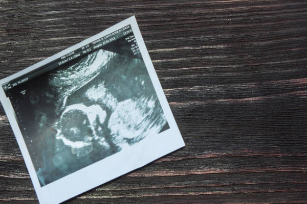 a22c62ebc0e8cf94b74dc3c3e5f07f0e.png 唐筛神经管畸形参考值是多少