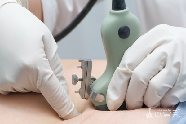 aae40b6666ced39f03f0a11dc1fed811.png 孕期神经管畸形检查什么项目