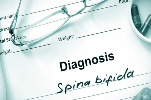 18d33dcebf518e6b80313ddc071eee8e.png 神经管畸形有什么影响