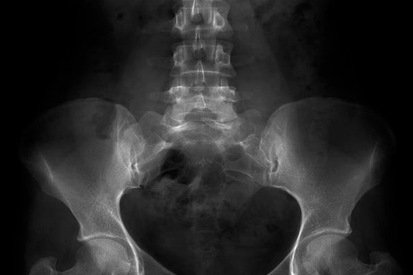 49f5b0e8a18fb0451a2f9190ae348a3d.png 检查神经管畸形正常值是多少到多少之间/