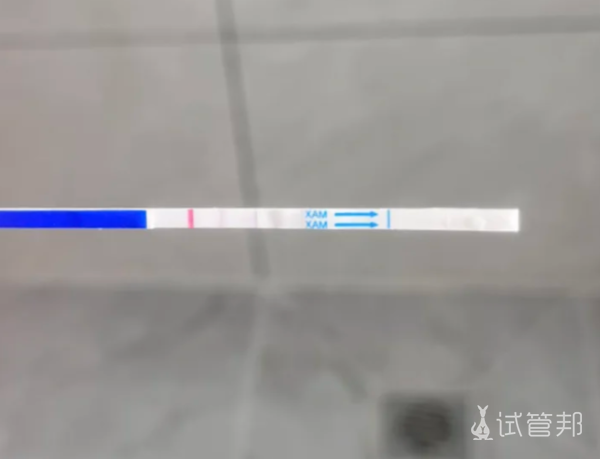 7c742fc54148d98739689ac5b151ab9a.png 因老公精子问题老阿姨走上了试管之路