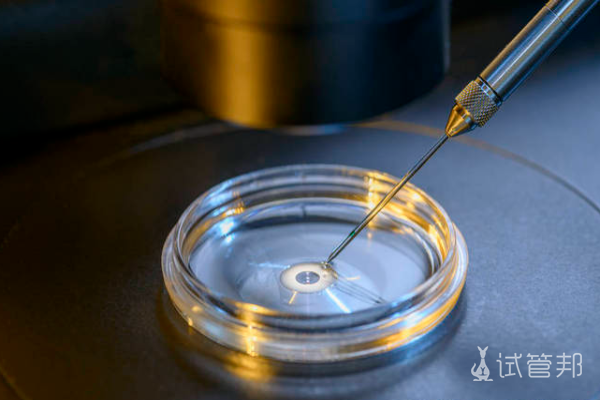 16ded1a793a00d58325bcd8e696b49a4.png 提高试管婴儿成功率怎么做