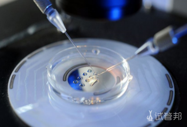 1cd92bee18dd7cd242458f8935c0acd2.png 试管婴儿长方案流程步骤