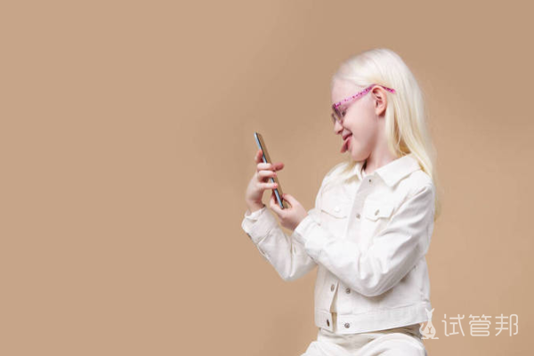 0a6c058c372d8381f3e9c50fa07a42e9.png 白化病眼睛有什么症状