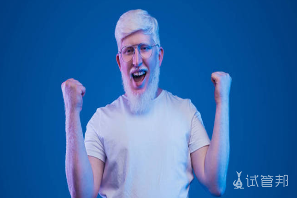 2764f73818bc035d1a17aa808d22b742.png 白化病眼睛会不会出现畏光反应