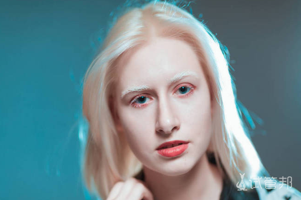 2afcc005e4c21de2b2d9a290e9f89a3b.png 白化病是不是近亲结婚引起的