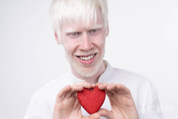 370bbf4004d50dba47467fd61f8e9e1a.png 白化病视力有正常的吗