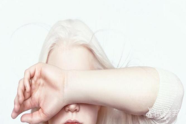 4f8115534f233b011097b9d48be1325d.png 先天性白化病会遗传吗