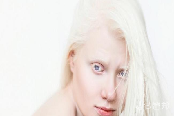 5ade8a085a980d2f4ae52ec7d0826188.png 哪些因素会导致白化病产生