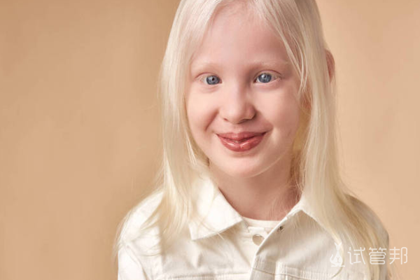 7004f9368fddc8c2dc9617cce7a26f03.png 白化病遗传方式是怎样的