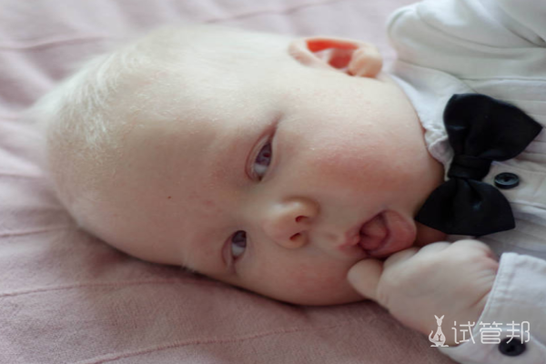 a4d04330a4adfffd88b6bebc0b6faed9.png 白化病是不是常染色体隐性遗传病