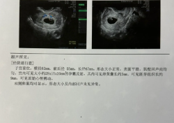 42岁高龄试管一促二移上岸，说说我的感想