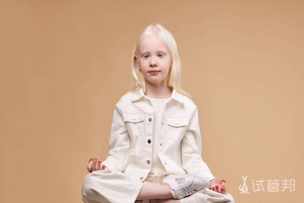 dba1fbb5dbb1a78434d6819341dc44a3.png 白化病眼睛有几种颜色