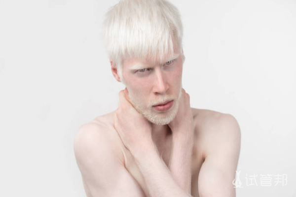 f4457f7f97cbf72728a441356cd4fa12.png 白化病患者皮肤要怎么保护