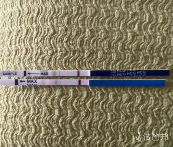 ff69d1c2a84de71fa5607f3f65d5c01c.png 决定做试管但内心的挣扎与压力无法忽视不知到底该怎么选择