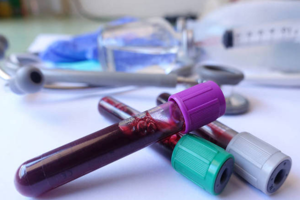 10ba5bddfa2e20fc18084d23fdf5753d.png 性激素六项检查有哪些项目