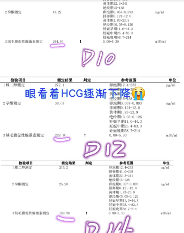 d3875da80678b417e5ea46738c114617.png 移植后出现生化多半是这几个因素在捣乱
