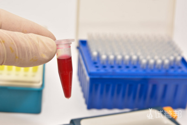 e9f53bec74906b4fe99ec04d73503716.png 性激素六项检查什么时间查