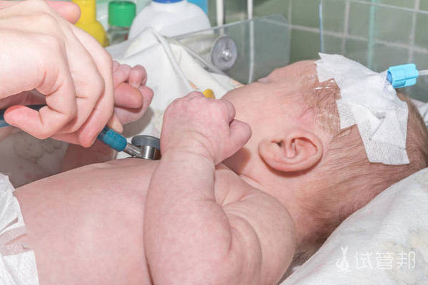 05d39309153082f79d9aebfafd1ac9fe.png abo溶血症具体表现有哪些