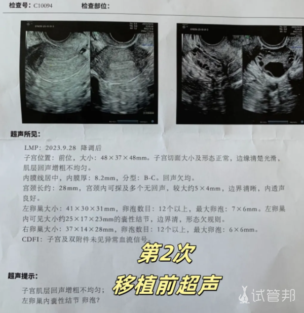 d51ad2daf73257a9b1cda6f4bc8aab04.png 试管婴儿一次成功取决于哪些因素