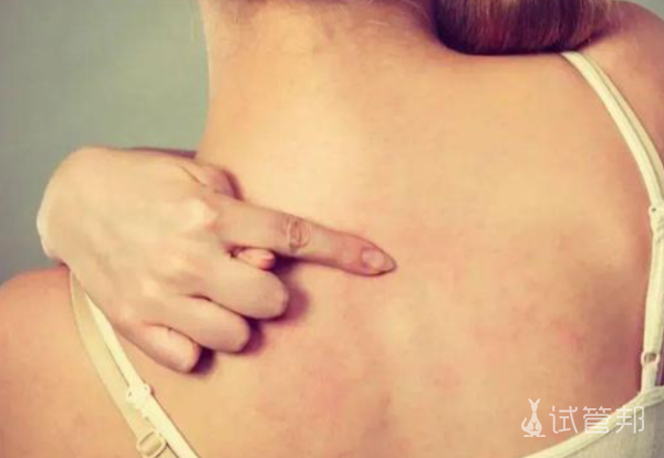 2f4e543211483800cb6c4613f0d3101a.png 红斑狼疮能治好吗