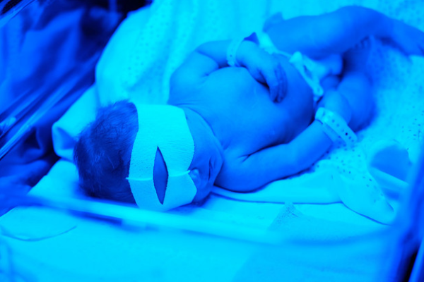 9b2f03dbabef7f707dabfb4618d4a702.png 新生儿abo溶血需要治疗多久