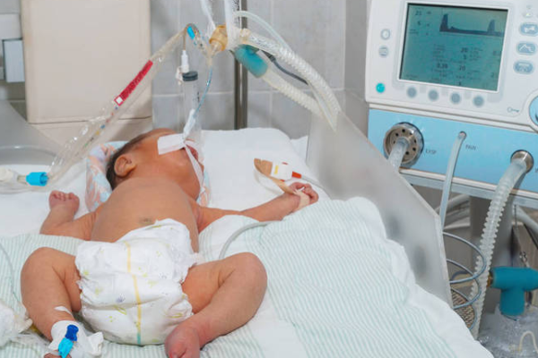 9ce10491dd3979b8795e80ad07c9076e.png 新生儿abo溶血性黄疸主要症状有哪些