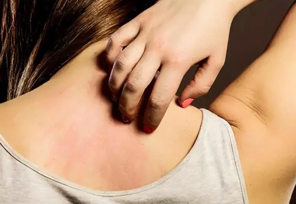 c988d0837d1103c3889f768b0dbc0983.png 红斑狼疮能活多久