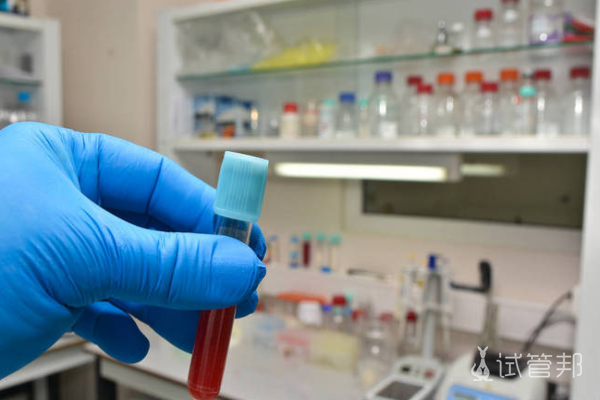 20fc0f71e28fcb361e5b8b3c4f30a526.png 女性血常规检查都有哪些项目