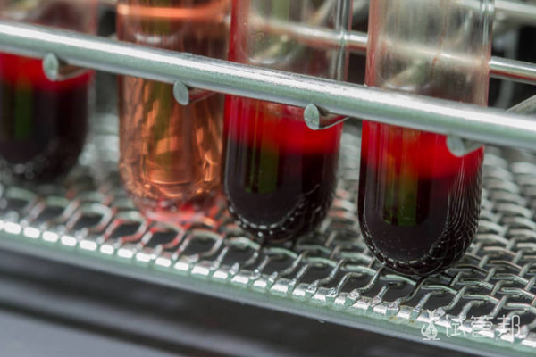 3c220a9e9de2ae7cc6359485258f9b86.png 血常规检查能下午查吗