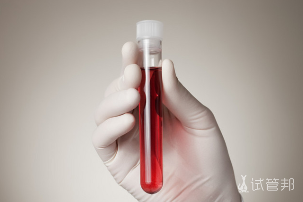 a8684cd2530c38735af2941bba554096.png 体检血常规检查项目多少钱