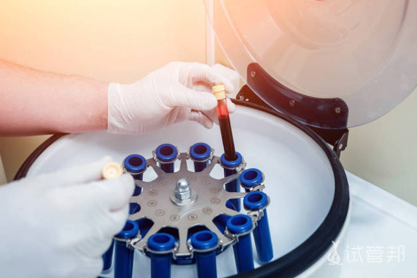 f36441477ee98c19639aa77c1411d6f6.png 女性血常规检查多少钱