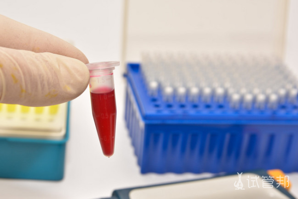 d4f515adf4594c08e407a2ba047d856f.png 血常规检查怀孕看哪个