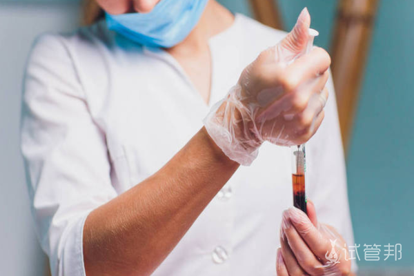 fb3ed5af98e75bcdfea526bd50ea696a.png 血常规检查主要看哪几项