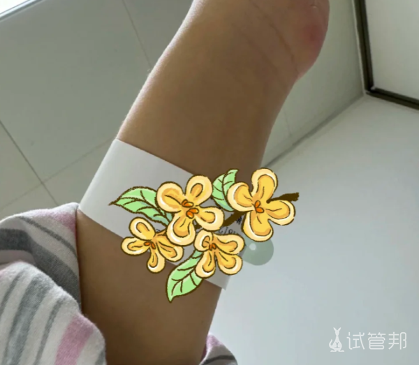 4a2b56427c78a11afee991e906dbbd5b.png 试管婴儿路上那些事儿常见问题大揭秘