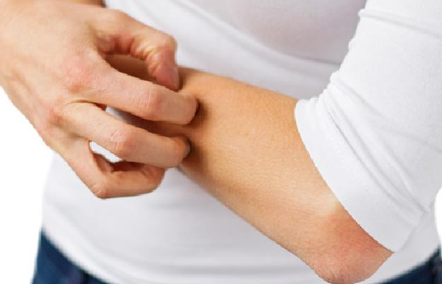 5bdef5883e2d99c9a29ca533c8ca5860.png 系统性红斑狼疮能活到正常寿命吗