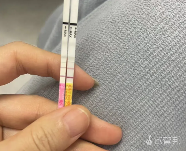 61fd9fb80fdd7706d6fd42f40a6a76d5.png 想要试管婴儿成功这些干货别错过