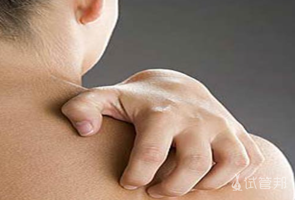 146bab108082258dd6296b315c5e6a56.png 系统性红斑狼疮治疗费用大概多少钱