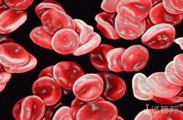 f25a78baad9d10eb1e501d42e9befca3.png 异常血红蛋白病和地中海贫血的区别
