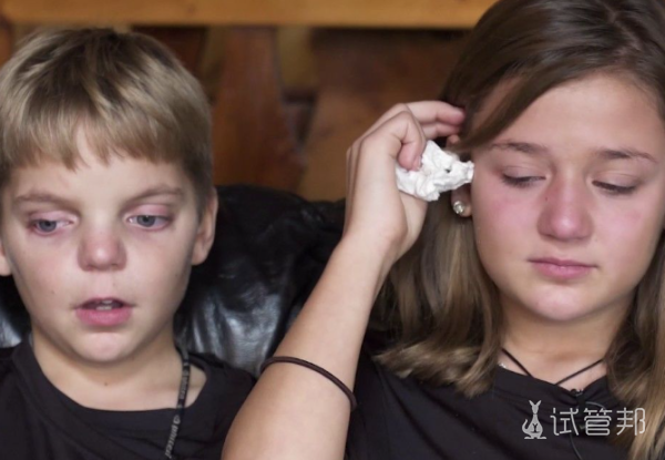 c930e8b27de5ce253f6af24cd8e0cd29.png 亨廷顿病的临床表现有哪些