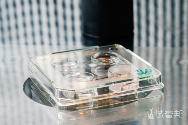 49109b407424e1c1c3e376add203061f.png 试管婴儿胚胎移植数量是多少