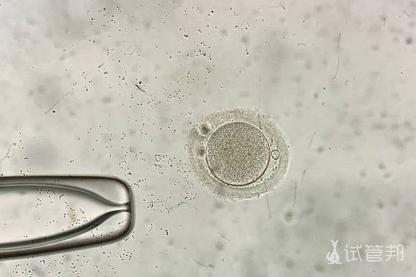 2c1a251ae36c34ff694644dede2fc09c.png 做试管需要调理身体吗